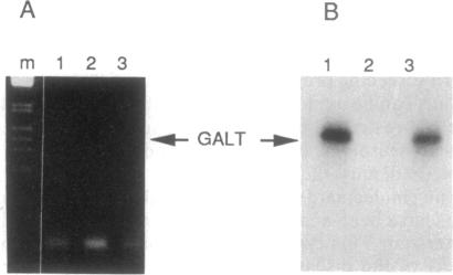 graphic file with name pnas01057-0031-a.jpg