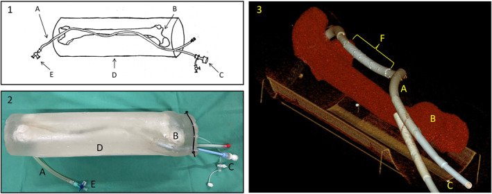 FIGURE 1