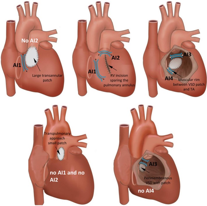 Figure 12