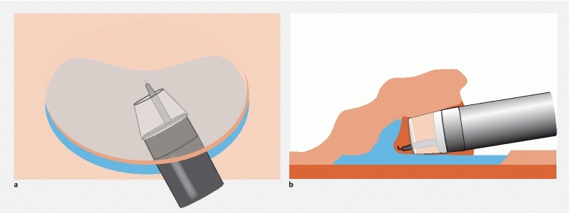 Fig. 3