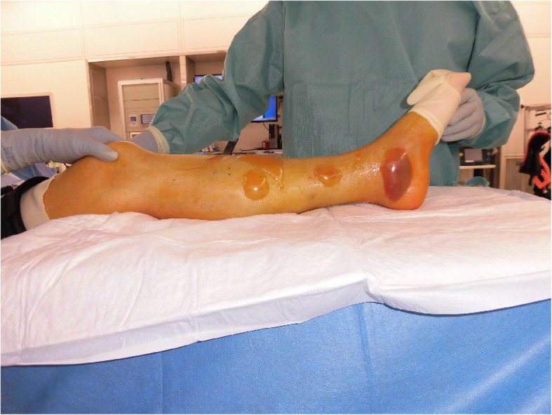 Fig. 2
