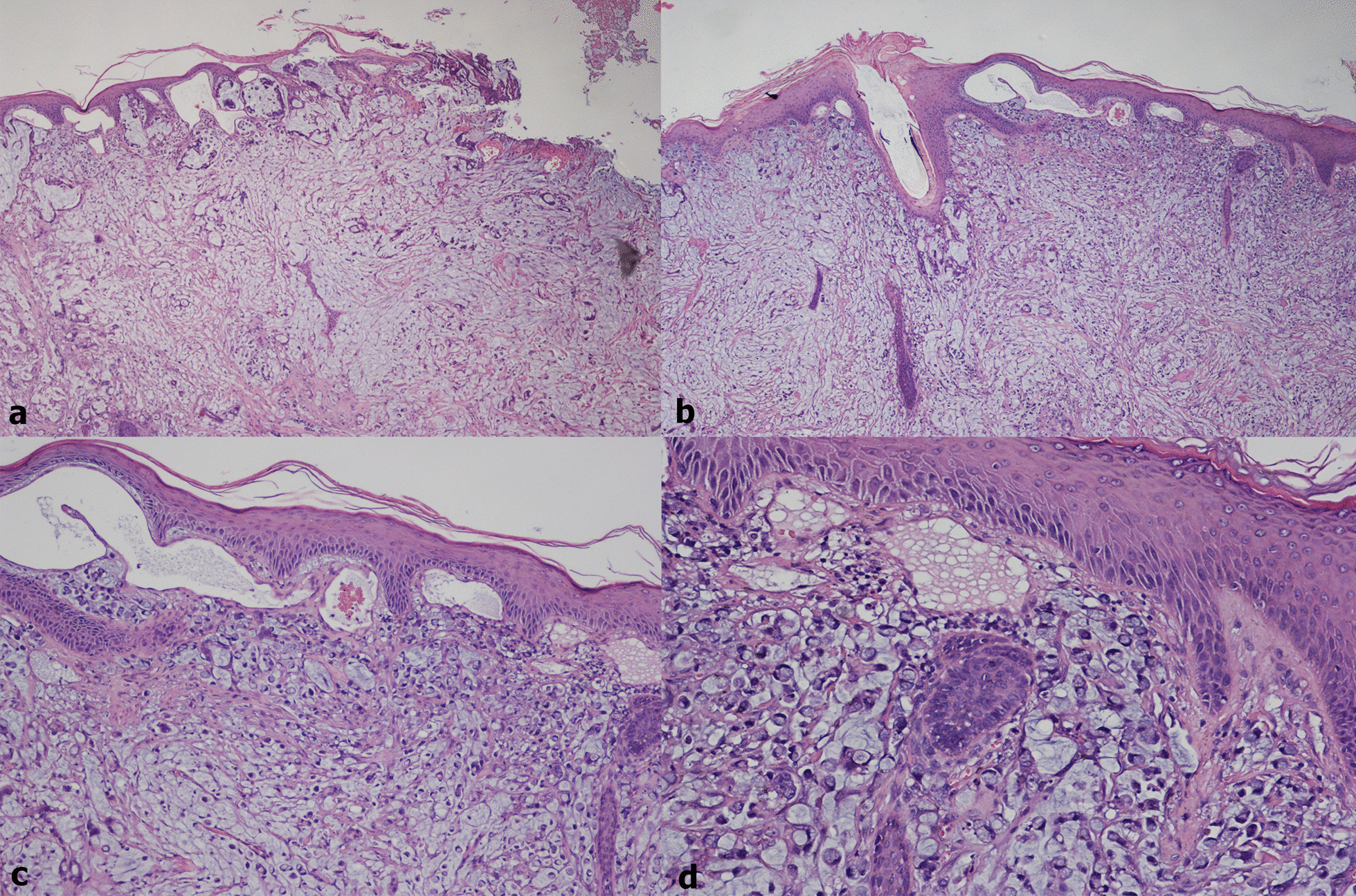 Fig. 2