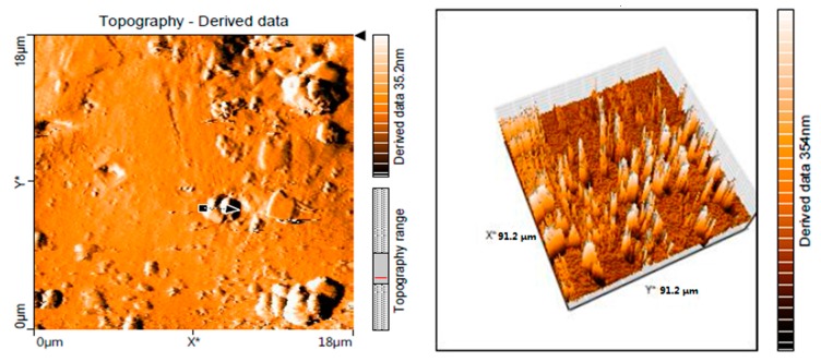 Figure 11