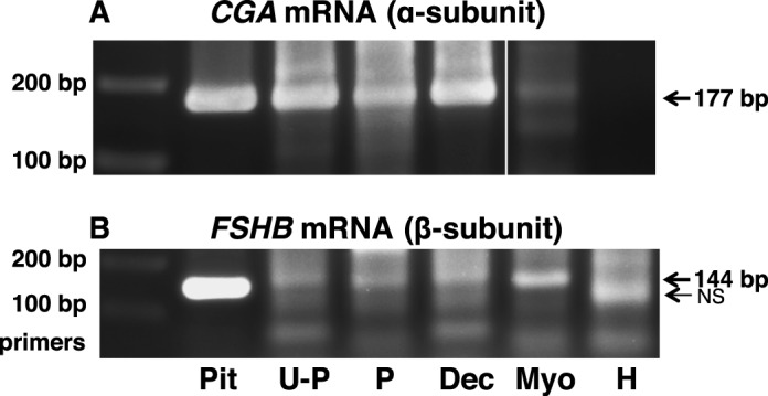 FIG. 12