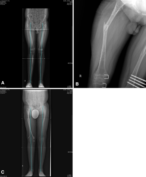 Fig. 1A–C