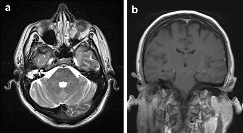 Fig. 2