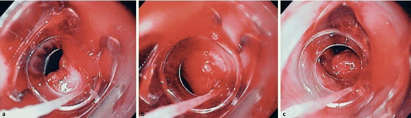 Fig. 1
