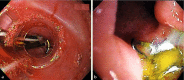 Fig. 3 a