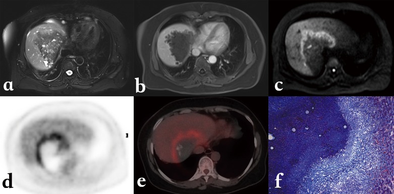 Figure 11.