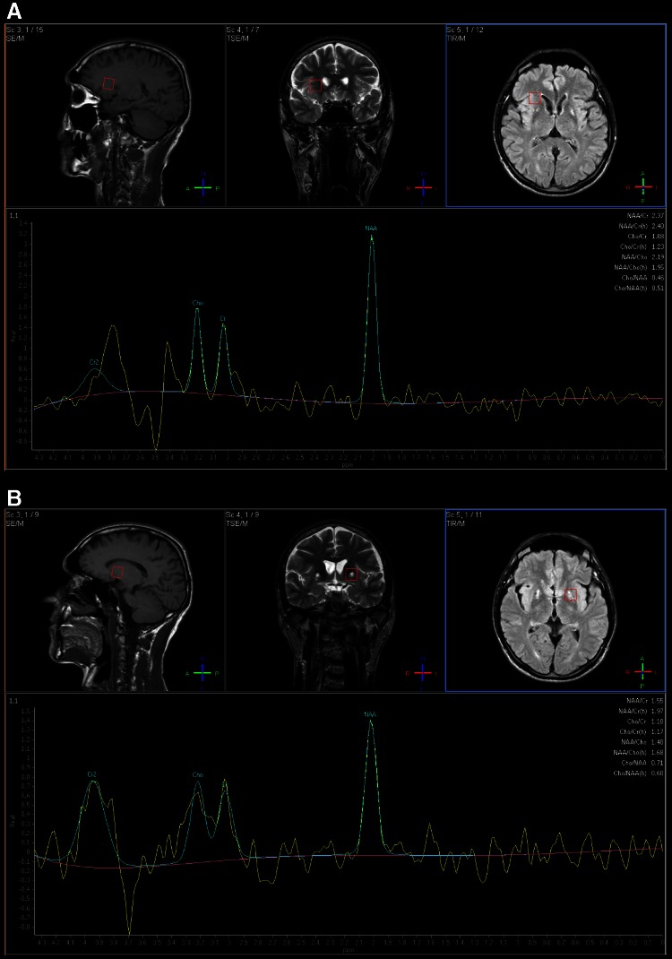 Fig. 2