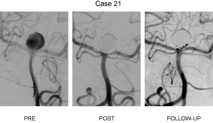 Fig 2.