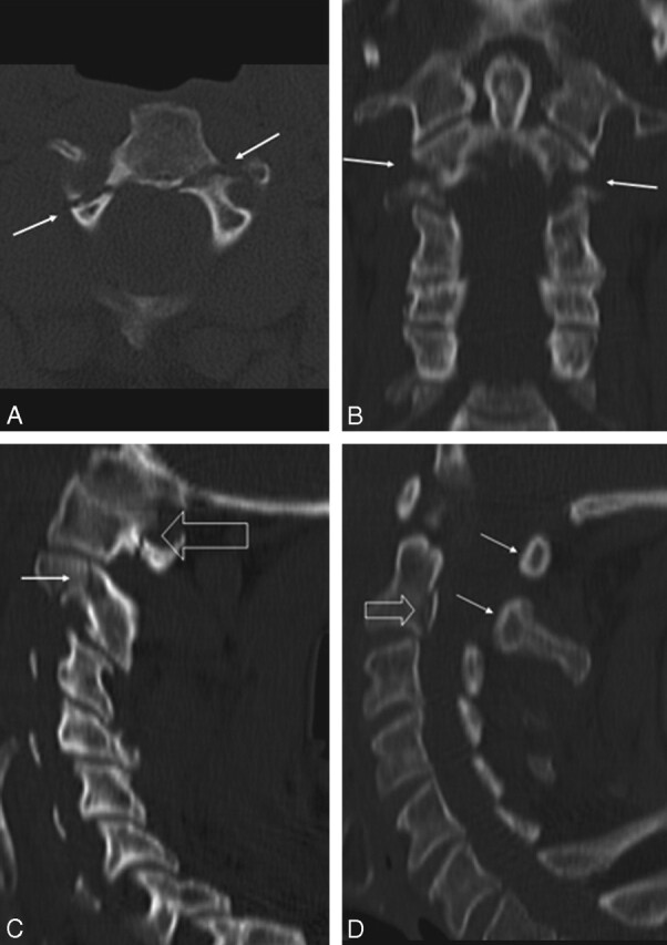 Fig 2.