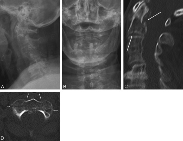 Fig 6.