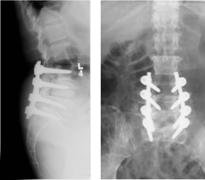 Fig. 3a–b