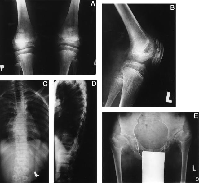 Figure  1