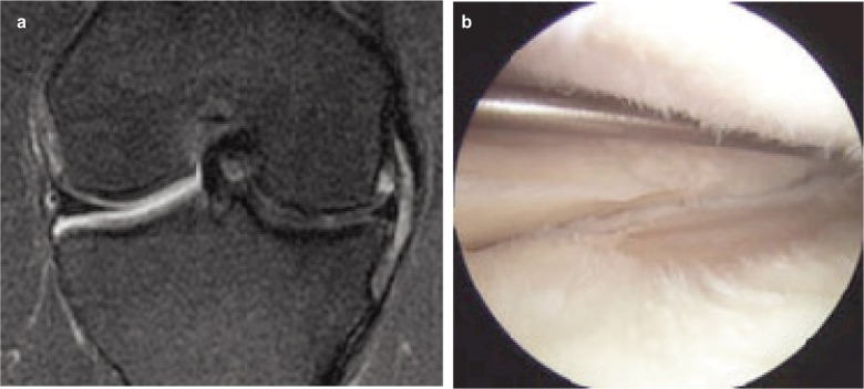 Fig. 1a-b