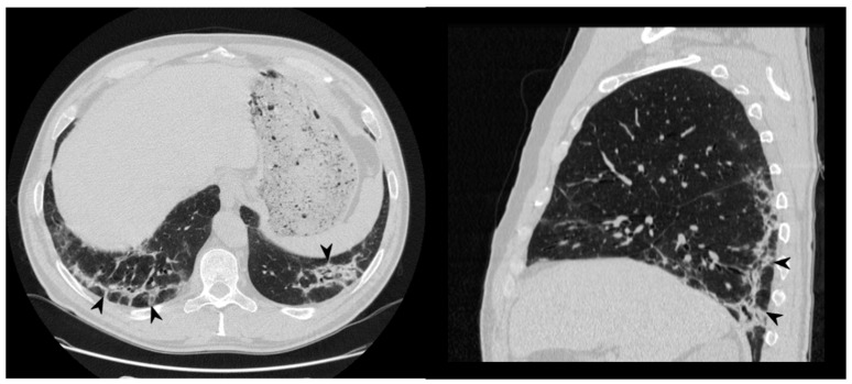 Figure 14