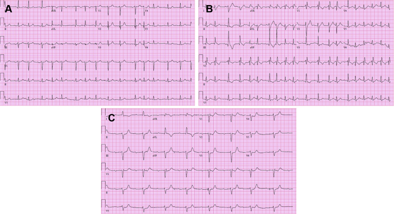 Figure 2