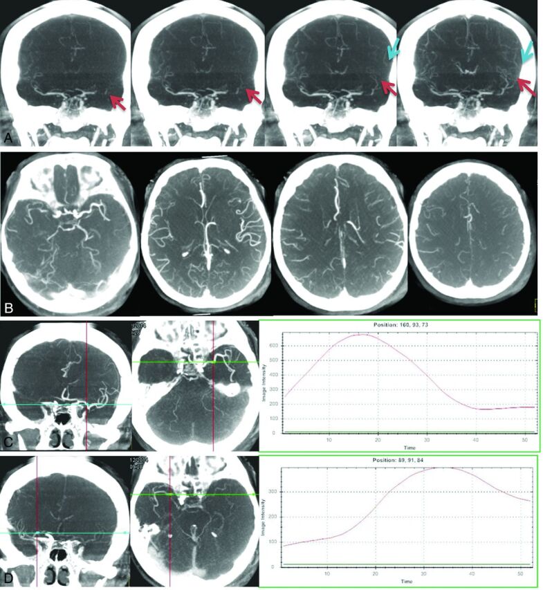 Fig 2.