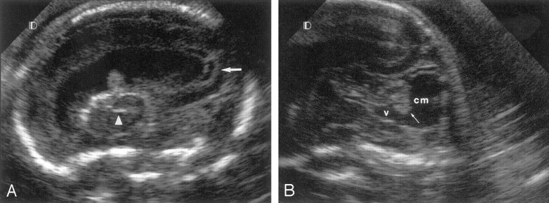 Fig 2.