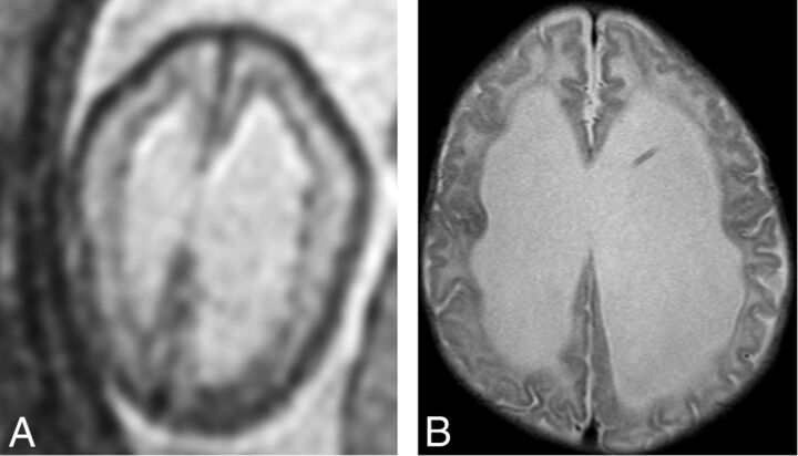 Fig 3.