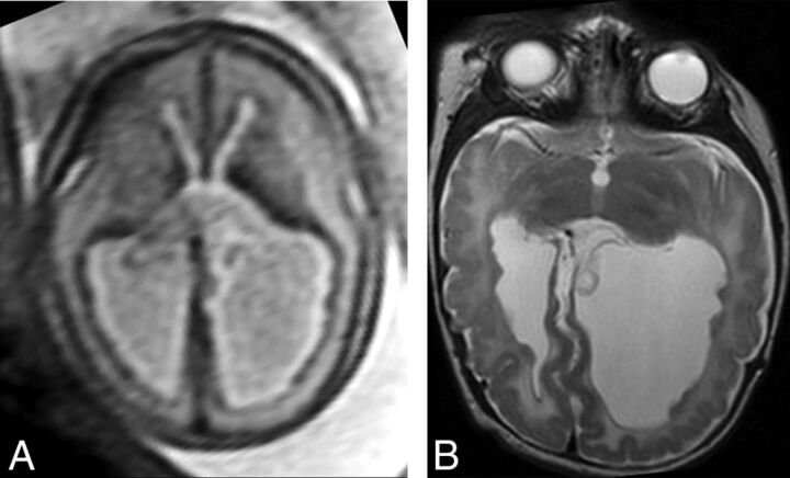 Fig 2.