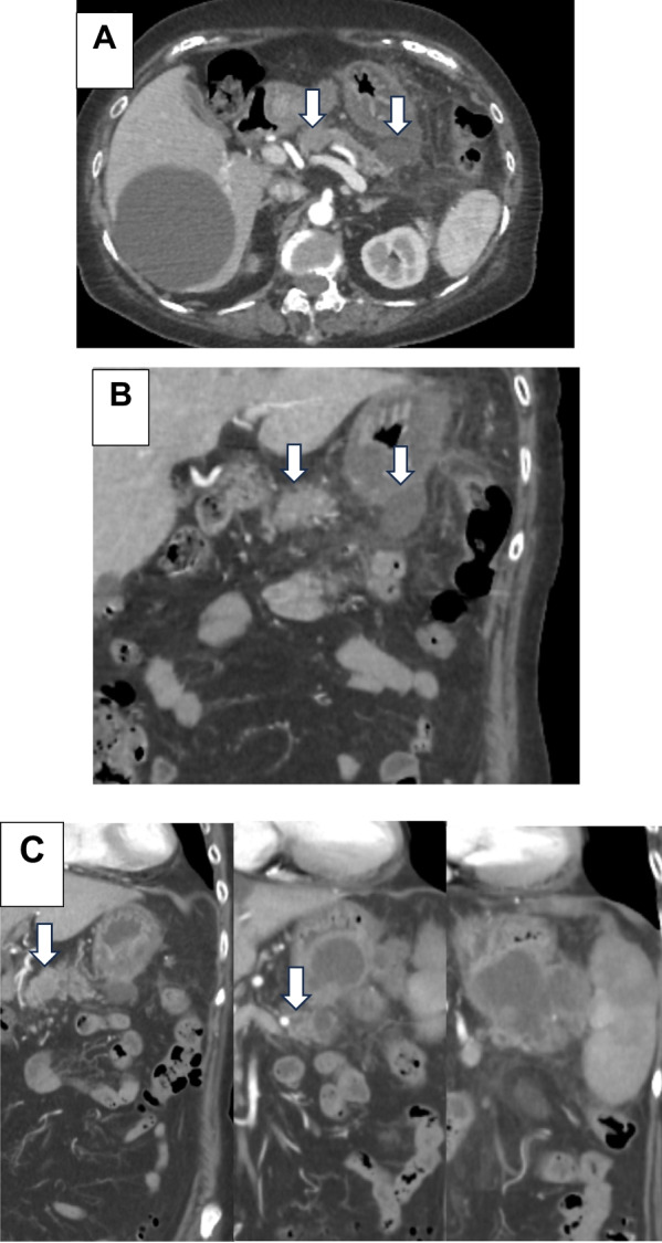 Fig. 1
