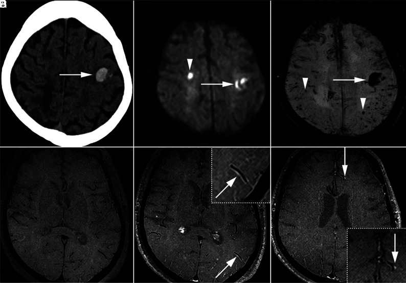 FIG 2.