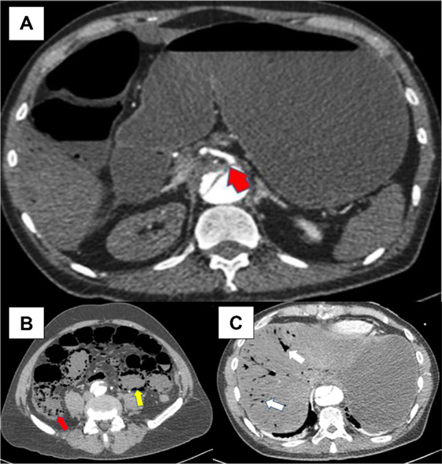 Fig. 4