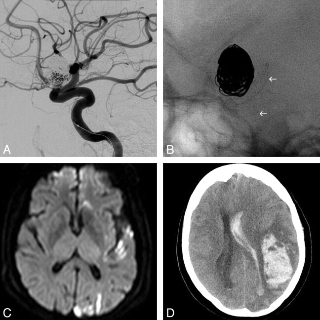 Fig 4.