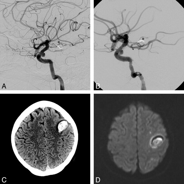 Fig 2.