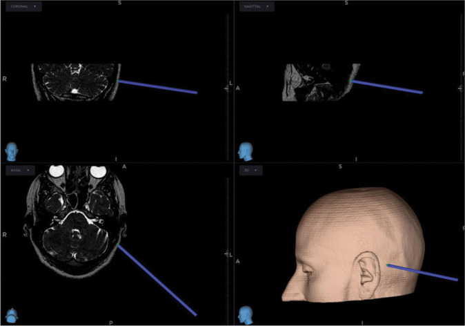 Figure 1: