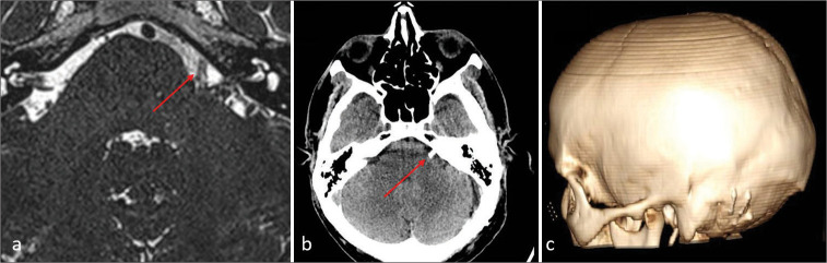 Figure 5: