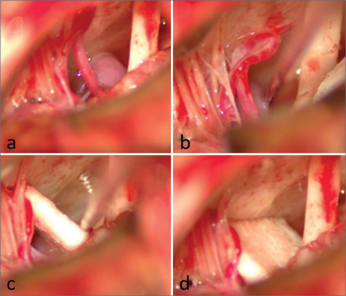 Figure 3: