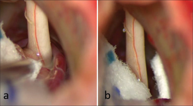 Figure 7: