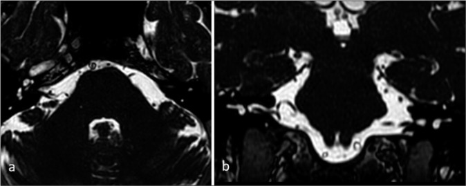 Figure 6: