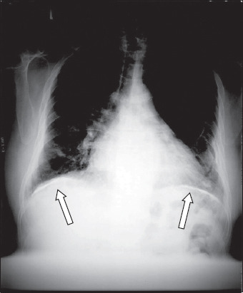 Fig. 12