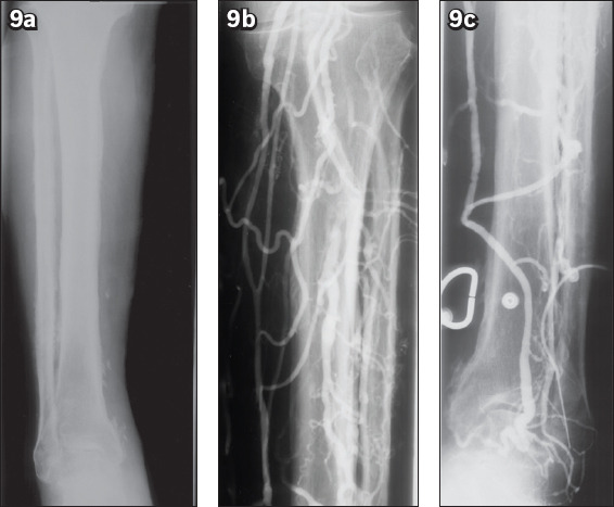 Fig. 9