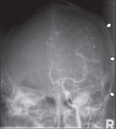 Fig. 14
