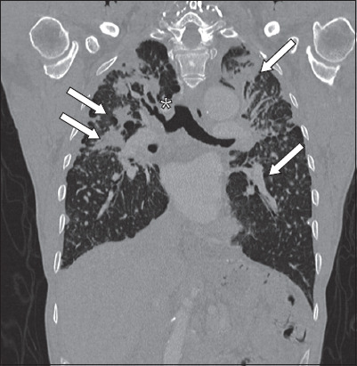 Fig. 11
