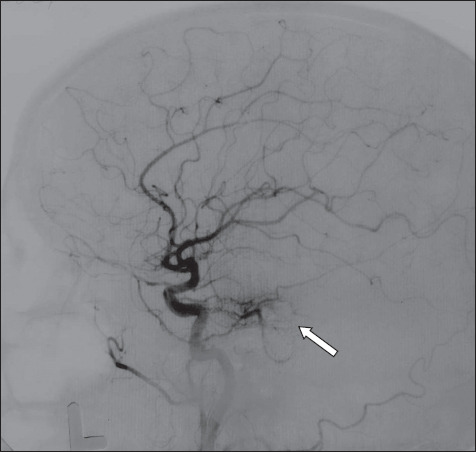 Fig. 15