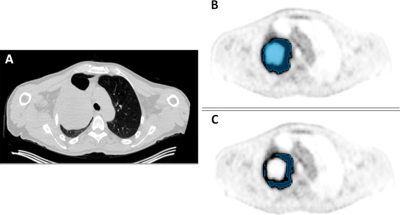 Fig. 5