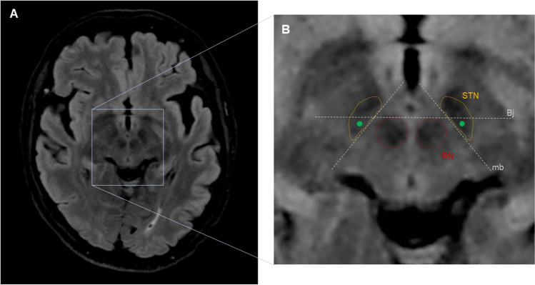 Fig. 1
