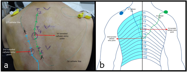 Fig. 1