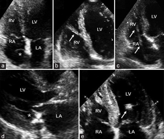 Figure 10