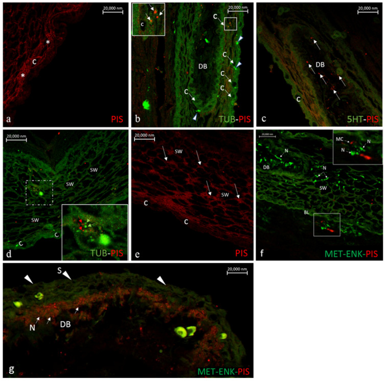 Figure 19