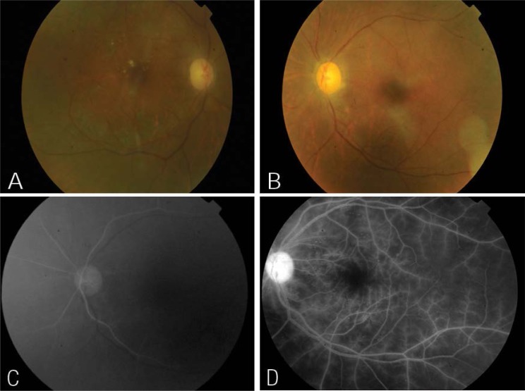 Figure 1: