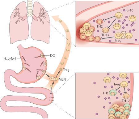 Figure for text box 3. H. pylori exerts systemic immunomodulatory effects