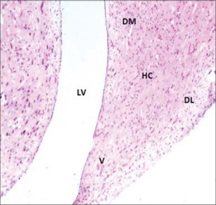 Figure-4