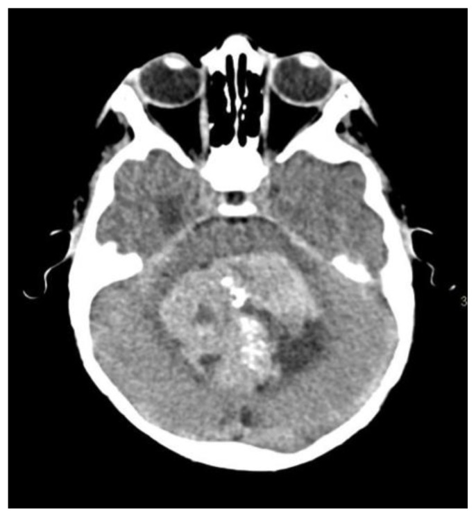 Figure 10